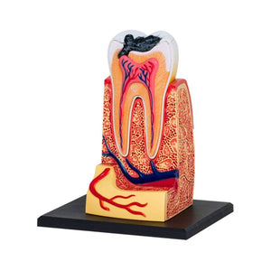 Triple - Root Molar Model – Discover the Hidden World Inside Your Tooth! - Fun Learning Store